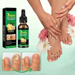 Dile adiós a los hongos en 7 días | Aceite Milagroso para Uñas