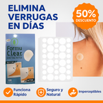 FormuClear™ - Elimina verrugas sin dolor y seguro + ENVIO GRATIS