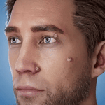 FormuClear™ - Elimina verrugas sin dolor y seguro + ENVIO GRATIS